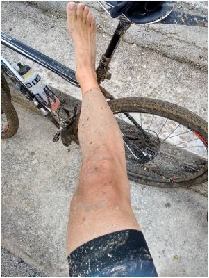BikeBlatoNoga